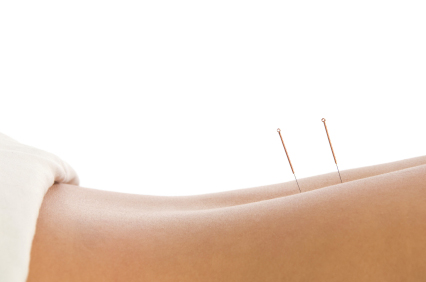 Improve Pain and Muscle Tighten with Vancouver IMS + Acupuncture